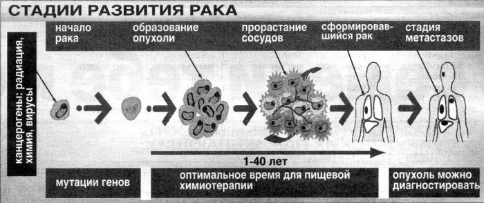 стадии развития рака